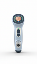 Digital otoscope with HD imaging